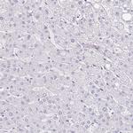 PADI2 Antibody in Immunohistochemistry (IHC)