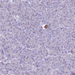 B4GALT2 Antibody in Immunohistochemistry (IHC)