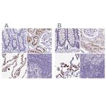 NAPSA Antibody in Immunohistochemistry (IHC)