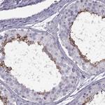 TBC1D3C Antibody in Immunohistochemistry (IHC)