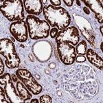 PCCA Antibody in Immunohistochemistry (IHC)