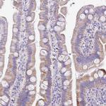 PCCA Antibody in Immunohistochemistry (IHC)