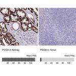 PCCA Antibody