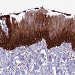 RAC1/RAC2/RAC3 Antibody in Immunohistochemistry (IHC)