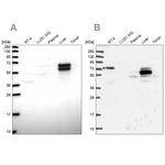 ACSS3 Antibody in Western Blot (WB)