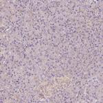 REEP6 Antibody in Immunohistochemistry (IHC)