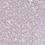 eIF2b beta Antibody in Immunohistochemistry (IHC)