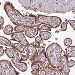 SIRPB2 Antibody in Immunohistochemistry (IHC)