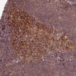 SIRPB2 Antibody in Immunohistochemistry (IHC)