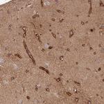 SIRPB2 Antibody in Immunohistochemistry (IHC)