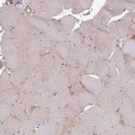 SIRPB2 Antibody in Immunohistochemistry (IHC)