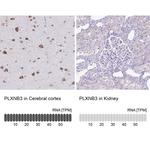 PLXNB3 Antibody in Immunohistochemistry (IHC)