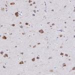 PLXNB3 Antibody in Immunohistochemistry (IHC)