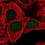 GSTO2 Antibody in Immunocytochemistry (ICC/IF)