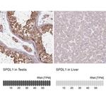 SPDL1 Antibody in Immunohistochemistry (IHC)