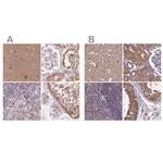 APOA1BP Antibody in Immunohistochemistry (IHC)