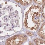 APOA1BP Antibody in Immunohistochemistry (IHC)