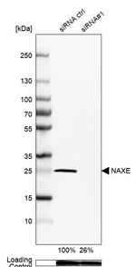 APOA1BP Antibody in Western Blot (WB)