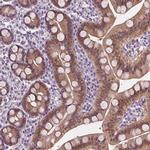 DAK Antibody in Immunohistochemistry (IHC)