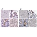 ACY3 Antibody in Immunohistochemistry (IHC)