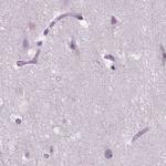 ACY3 Antibody in Immunohistochemistry (IHC)