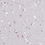 GLCE Antibody in Immunohistochemistry (IHC)