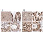 GLYR1 Antibody in Immunohistochemistry (IHC)