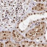 GLYR1 Antibody in Immunohistochemistry (IHC)