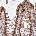 GLYR1 Antibody in Immunohistochemistry (IHC)