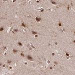 GLYR1 Antibody in Immunohistochemistry (IHC)