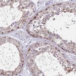 FTSJD1 Antibody in Immunohistochemistry (IHC)