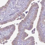 GALNT12 Antibody in Immunohistochemistry (IHC)