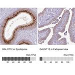 GALNT12 Antibody