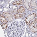 ACAD11 Antibody in Immunohistochemistry (IHC)