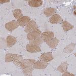 ACAD11 Antibody in Immunohistochemistry (IHC)