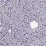 ACAD11 Antibody in Immunohistochemistry (IHC)