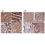 ATP5H Antibody in Immunohistochemistry (IHC)