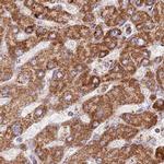 ATP5H Antibody in Immunohistochemistry (IHC)