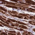 ATP5H Antibody in Immunohistochemistry (IHC)