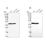 MRPS9 Antibody in Western Blot (WB)