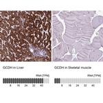 GCDH Antibody in Immunohistochemistry (IHC)