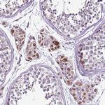 GCDH Antibody in Immunohistochemistry (IHC)