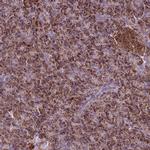 GCDH Antibody in Immunohistochemistry (IHC)