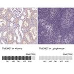 TMEM27 Antibody in Immunohistochemistry (IHC)