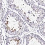 WBP2NL Antibody in Immunohistochemistry (IHC)