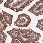 WDFY3 Antibody in Immunohistochemistry (IHC)