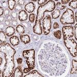 QTRT1 Antibody in Immunohistochemistry (IHC)