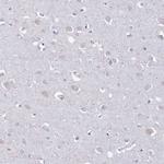 LTB Antibody in Immunohistochemistry (IHC)