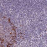 LTB Antibody in Immunohistochemistry (IHC)