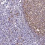 GNAQ Antibody in Immunohistochemistry (IHC)